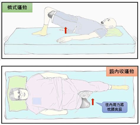 截刀臥位姿勢|截肢手術病人之照護 